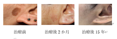 syourei1